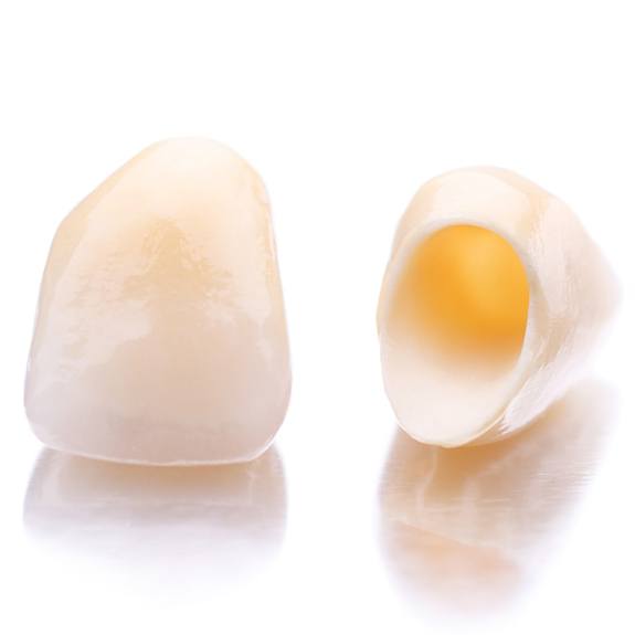 Close-up of two CEREC same-day dental crowns in Burbank, CA