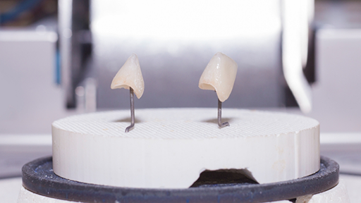 Model of two dental crowns