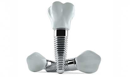 Illustration of three dental implants with crowns