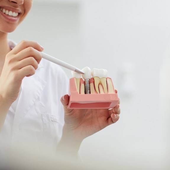 Dentist using model smile to explain the four step dental implant process