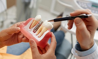 Dentist pointing to model of dental implant