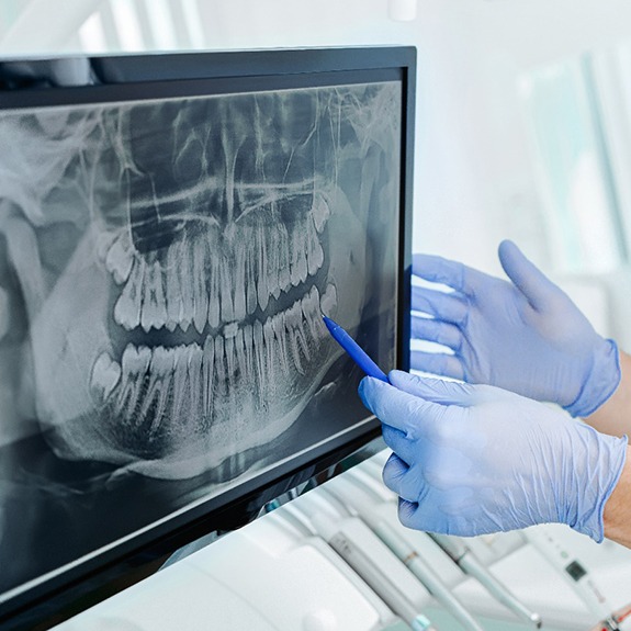 Dentist using pen to point to X-ray