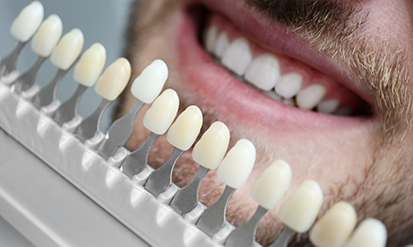 Shade guide in front of a man's smile