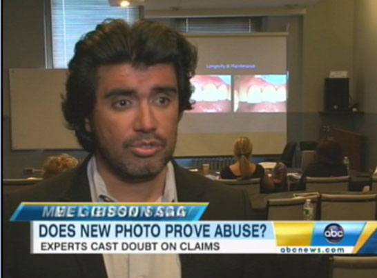 Doctor Ruiz on Good morning America