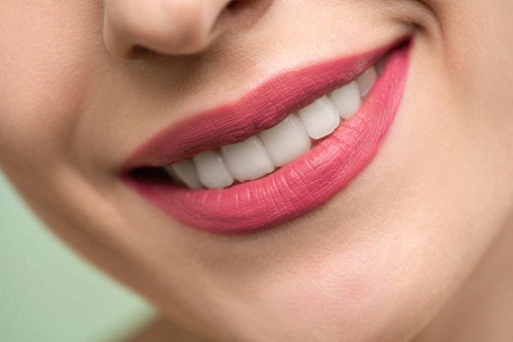 women with white teeth