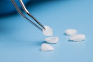 Dentist picking up veneers with dental tweezers